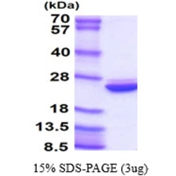 Human UBE2H protein, His tag. GTX67922-pro