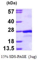 Human PTP4A2 protein, His tag. GTX67960-pro