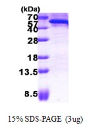 Human CDC123 protein, His tag. GTX68011-pro