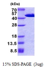 Human FIBP protein, His tag. GTX68031-pro