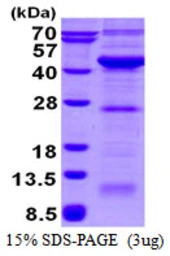 Human VPS26A protein, His tag. GTX68079-pro
