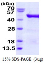 Human EIF4A3 protein, His tag. GTX68090-pro