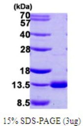 Human DNAL4 protein, His tag. GTX68120-pro