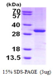 Human CITED2 protein, His tag. GTX68145-pro