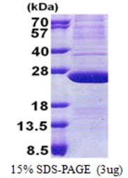 Human ATP5H protein, His tag. GTX68159-pro