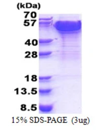 Human DCTN2 protein, His tag. GTX68170-pro