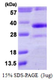 Human DHRS4 protein, His tag. GTX68198-pro