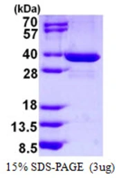 Human SPIN1 protein, His tag. GTX68203-pro
