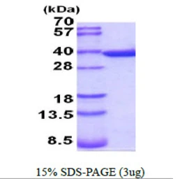Mouse Annexin V protein, His tag. GTX68255-pro