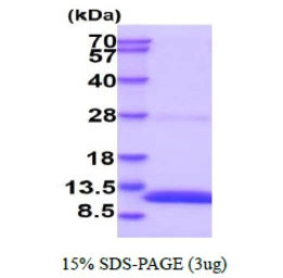 Mouse S100 beta protein, His tag. GTX68289-pro