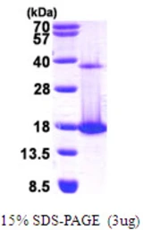 Human COTL1 protein, His tag. GTX68321-pro
