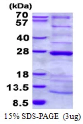 Human HRPAP20 protein, His tag. GTX68425-pro
