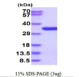 Human THYN1 protein, His tag. GTX68429-pro