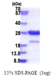 Human Amisyn protein, His tag. GTX68431-pro
