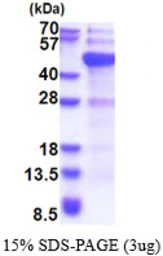 Human DNMT3L protein, His tag. GTX68449-pro