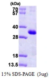 Human CSEN protein, His tag. GTX68453-pro