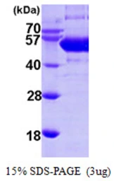 Human SLA/LP protein, His tag. GTX68473-pro