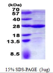 Human GLTP protein, His tag. GTX68489-pro