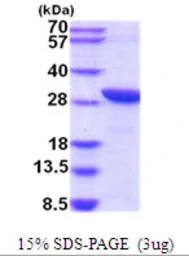 Human C20orf11 protein, His tag. GTX68572-pro
