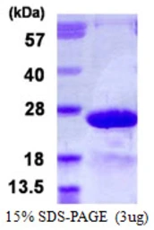 Human MYL7 protein, His tag. GTX68673-pro