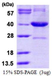 Human Serine racemase protein, His tag. GTX68682-pro