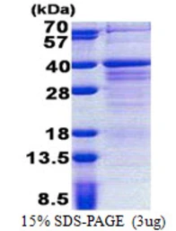 Human WIG1 protein, His tag. GTX68696-pro