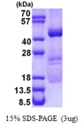 Human OBFC1 protein, His tag. GTX68750-pro