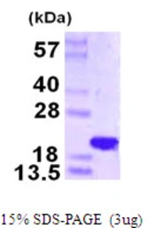 Human NAT13 protein, His tag. GTX68757-pro