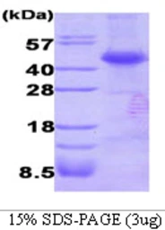 Human Dysbindin protein, His tag. GTX68795-pro