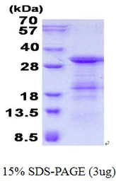 Human SLD5 protein, His tag. GTX69573-pro