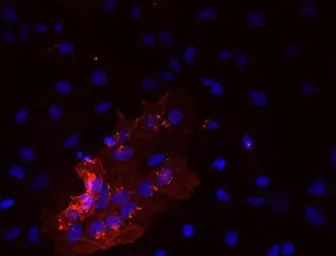 Anti-SSEA-5 antibody [8e11] used in Immunocytochemistry/ Immunofluorescence (ICC/IF). GTX70019