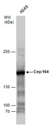 Anti-CEP164 antibody [17] used in Western Blot (WB). GTX70096