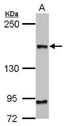 Anti-CEP164 antibody [17] used in Western Blot (WB). GTX70096