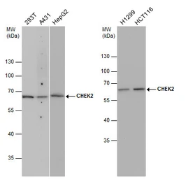 Anti-Chk2 antibody [4B8] used in Western Blot (WB). GTX70100