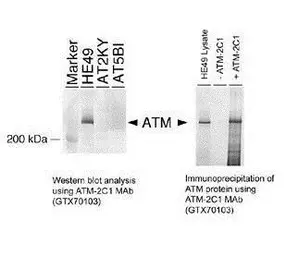 Anti-ATM antibody [2C1] used in Western Blot (WB). GTX70103