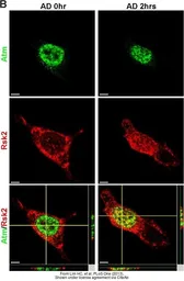 Anti-ATM antibody [2C1] used in Immunocytochemistry/ Immunofluorescence (ICC/IF). GTX70103