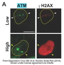Anti-ATM antibody [2C1] used in Immunocytochemistry/ Immunofluorescence (ICC/IF). GTX70103