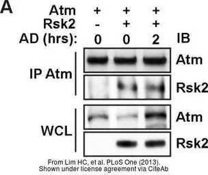 Anti-ATM antibody [2C1] used in Western Blot and Immunoprecipitation (WB IP). GTX70103