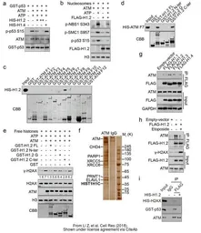 Anti-ATM antibody [2C1] used in Western Blot and Immunoprecipitation (WB IP). GTX70103