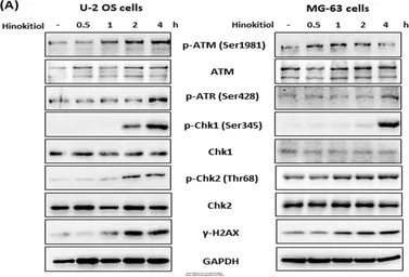 Anti-ATM antibody [2C1] used in Western Blot (WB). GTX70103