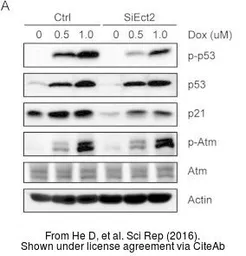 Anti-ATM antibody [2C1] used in Western Blot (WB). GTX70103