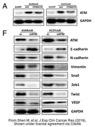 Anti-ATM antibody [2C1] used in Western Blot (WB). GTX70103