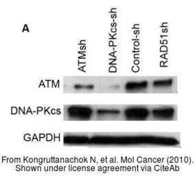 Anti-ATM antibody [2C1] used in Western Blot (WB). GTX70103