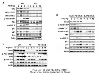 Anti-ATM antibody [2C1] used in Western Blot (WB). GTX70103