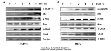 Anti-ATM antibody [2C1] used in Western Blot (WB). GTX70103