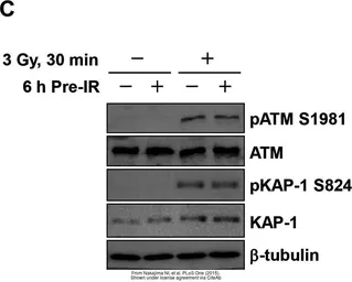 Anti-ATM antibody [2C1] used in Western Blot (WB). GTX70103
