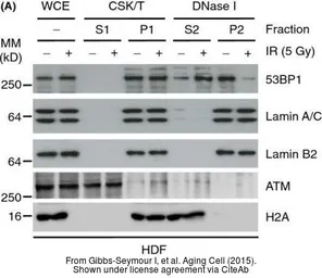 Anti-ATM antibody [2C1] used in Western Blot (WB). GTX70103