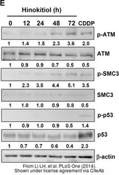 Anti-ATM antibody [2C1] used in Western Blot (WB). GTX70103