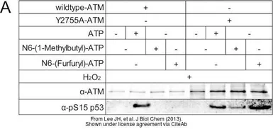 Anti-ATM antibody [2C1] used in Western Blot (WB). GTX70103