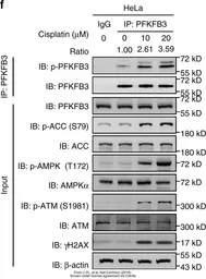 Anti-ATM antibody [2C1] used in Western Blot (WB). GTX70103